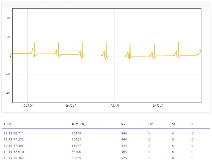 Heart rate variability